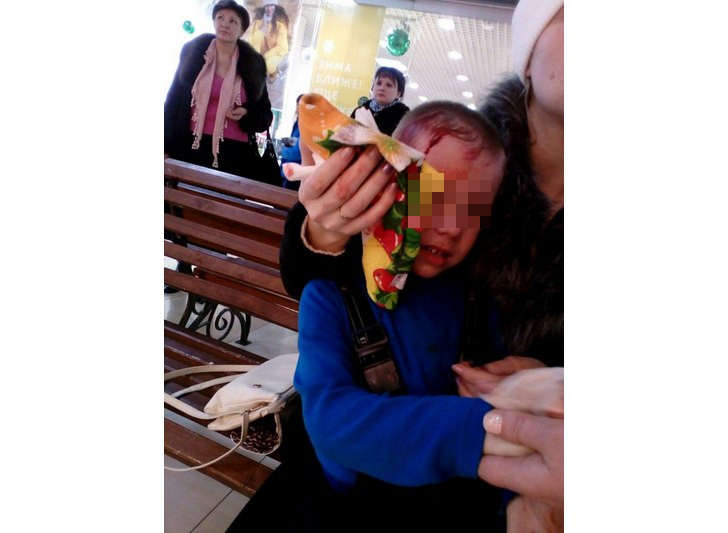 В Башкирии от падения витринного стекла пострадал ребенокВ Башкирии от падения витринного стекла пострадал ребенок